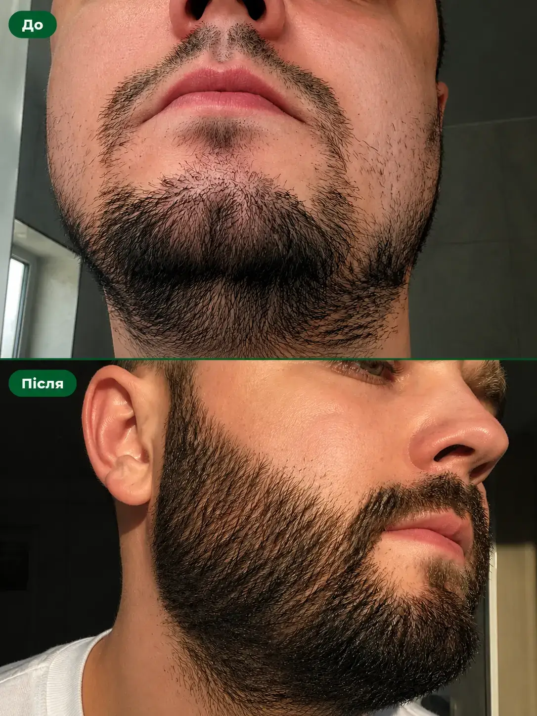 HAIRVITA для бороди